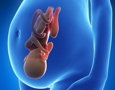 Xét nghiệm chẩn đoán nhanh hội chứng Down ở thai nhi